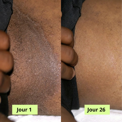 Nola Savon Purifiant Antifongique