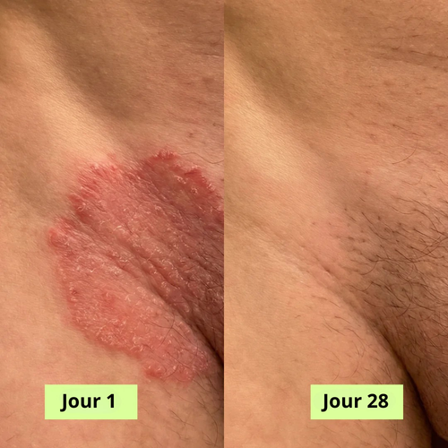 Nola Savon Purifiant Antifongique
