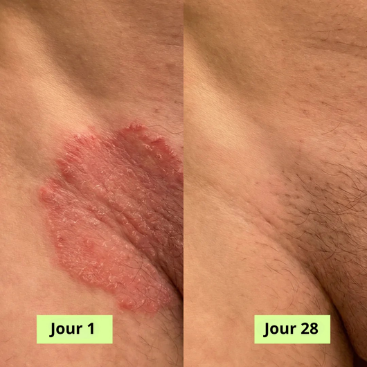 Nola Savon Purifiant Antifongique