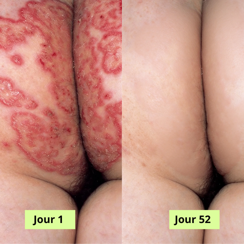 Nola Savon Purifiant Antifongique