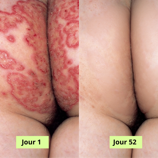 Nola Savon Purifiant Antifongique