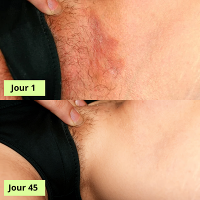 Nola Savon Purifiant Antifongique