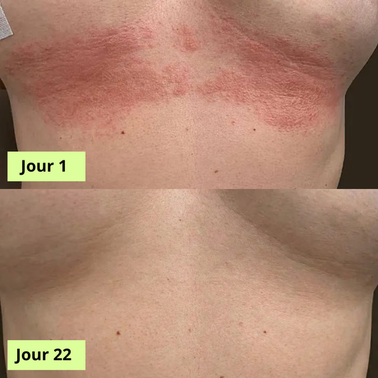 Nola Rituel Savon Purifiant Antifongique