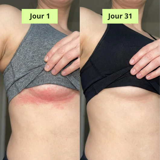Nola Rituel Savon Purifiant Antifongique