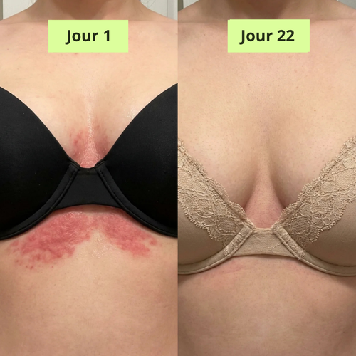 Nola Rituel Savon Purifiant Antifongique