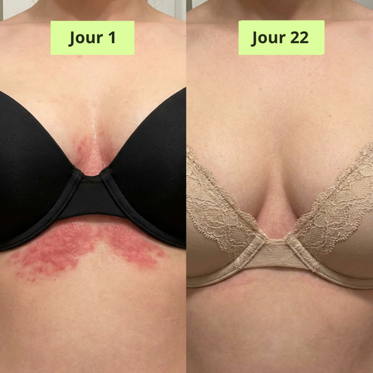 Nola Rituel Savon Purifiant Antifongique